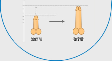 加拿大生物反馈诊疗系统